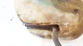 Pumpe Scheibenwaschanlage