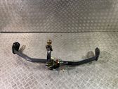 Tow bar set