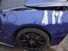 Other body part 