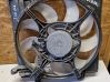 Aro de refuerzo del ventilador del radiador B1400004