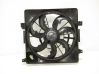 Radiator cooling fan shroud 