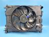 Radiator set 214104684R