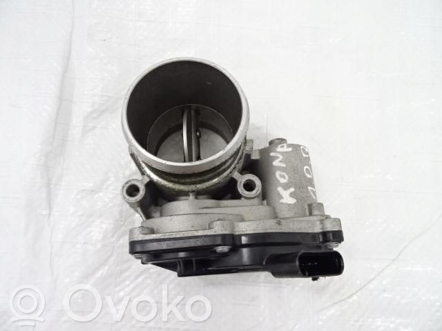 Hyundai i20 (BC3 BI3) Drosele 