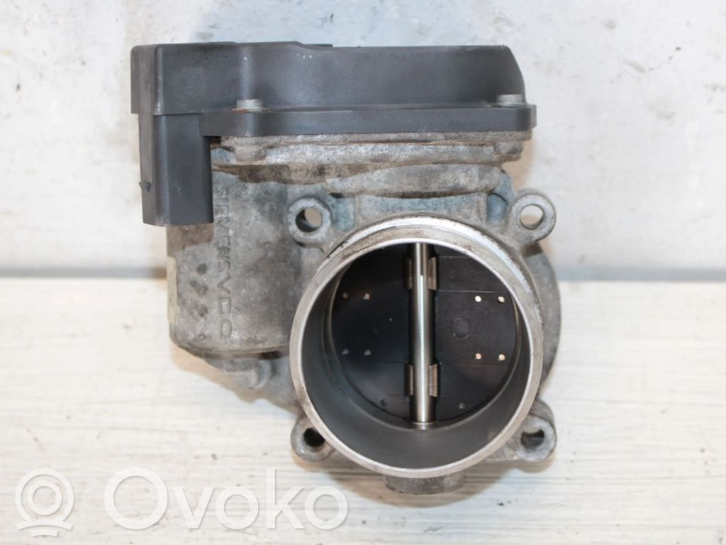 Audi TT TTS Mk2 Throttle valve 