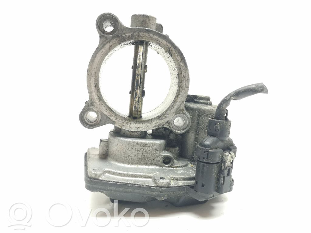 BMW 3 E90 E91 Engine shut-off valve 