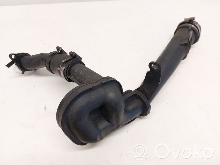 Citroen C5 Interkūlerio žarna (-os)/ vamzdelis (-iai) 9651164580