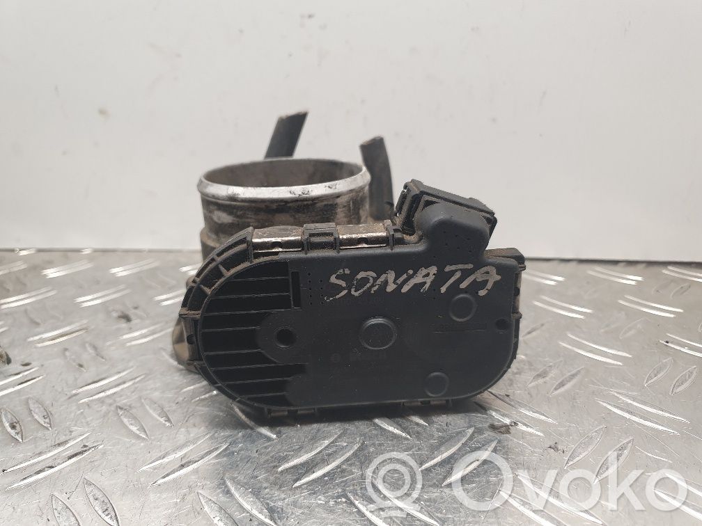 Hyundai Sonata Throttle valve 