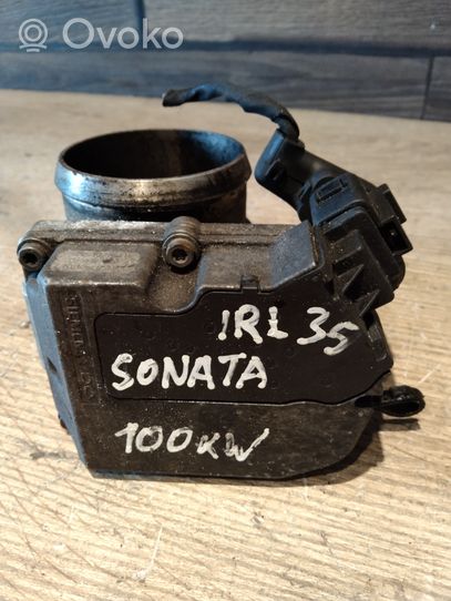 Hyundai Sonata Throttle valve A2C53027521