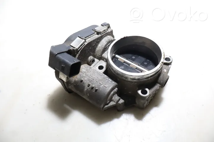 BMW 3 E90 E91 Engine shut-off valve 