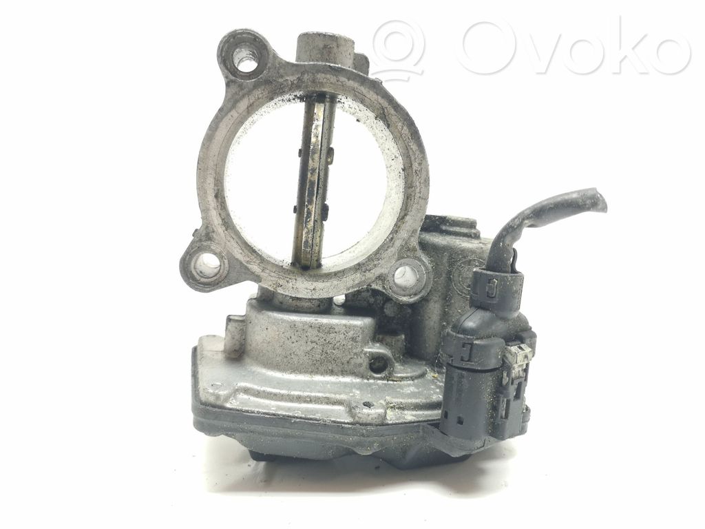 BMW 3 E90 E91 Engine shut-off valve 